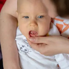 Dziecko z otwartymi ustami, któremu rodzic podnosi wargę, pokazując dziąsła.
