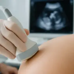 Ginekolog wykonuje USG. Na ekranie widać zarodek, to **6 tydzień ciąży**.