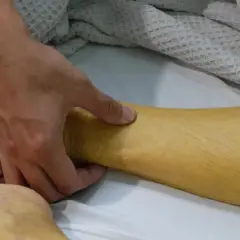 Dłoń dotyka zażółconej skóry nogi pacjenta.
