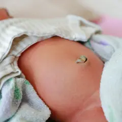 Zbliżenie na pępek noworodka z widocznym kikucem pępowinowym.