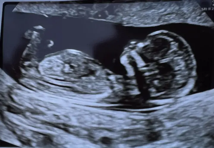USG płodu, widać główkę i tułów. To zdjęcie z okresu, w ktorym tygodniu widac plec.