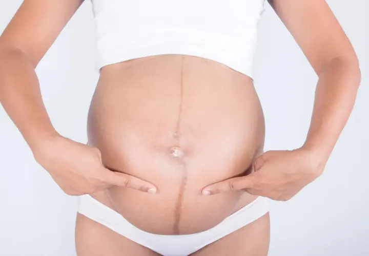 Ciężarna kobieta wskazuje palcami na ciemną linię biegnącą przez środek brzucha, zwaną linea negra.