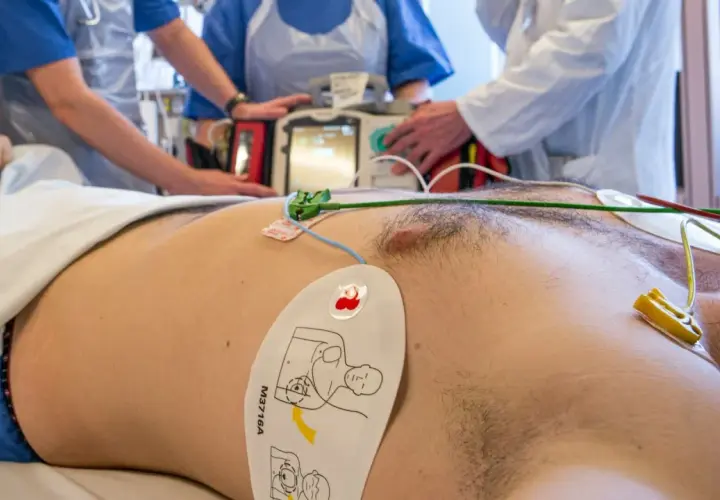 Pacjent z elektrodami EKG i defibrylatorem w tle, otoczony przez personel medyczny.