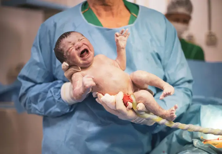 Noworodek trzymany przez lekarza w rękawiczkach, z widoczną pępowiną.