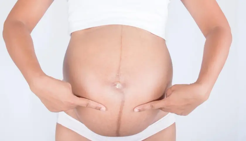 Ciężarna kobieta wskazuje palcami na ciemną linię biegnącą przez środek brzucha, zwaną linea negra.