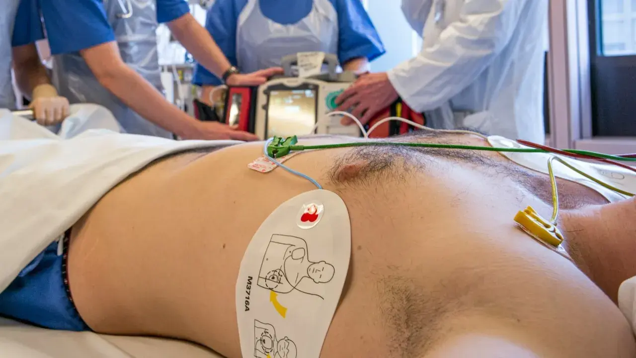 Pacjent z elektrodami EKG i defibrylatorem w tle, otoczony przez personel medyczny.